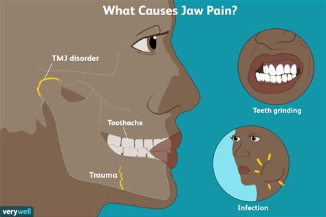 The Potential Causes of Jaw Pain and How It's Treated