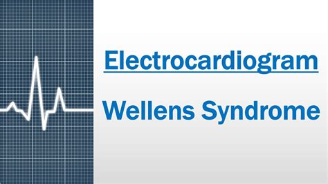 Wellens Syndrome - Diagnostic criteria and Pathophysiology ...