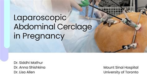 Laparoscopic Abdominal Cerclage in Pregnancy - YouTube