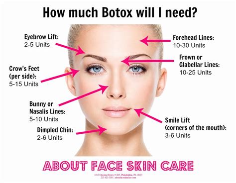 Face Diagram For Botox Injection