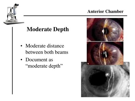 PPT - Slit Lamp Exam Findings PowerPoint Presentation, free download ...