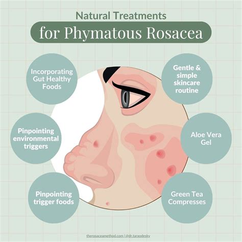 Type 3 Phymatous Rosacea Nose & Face Symptoms + Proven Treatment