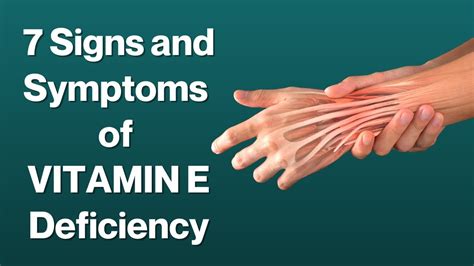 7 Signs and Symptoms of Vitamin E Deficiency | VisitJoy - YouTube