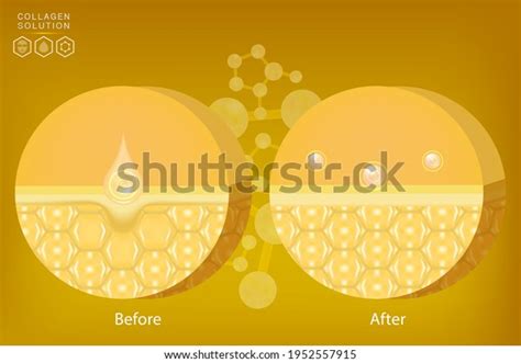 Hyaluronic Acid Before After Skin Solutions Stock Vector (Royalty Free) 1952557915 | Shutterstock