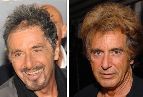 Al Pacino Plastic Surgery, Wig And Bald Pictures | Celebrities male ...