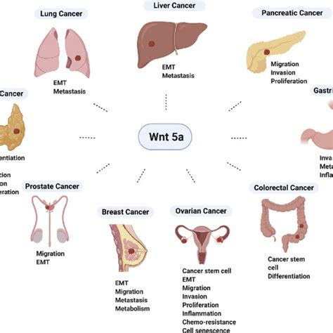 Overview of non-canonical Wnt signaling pathway in cancer (PCP ...