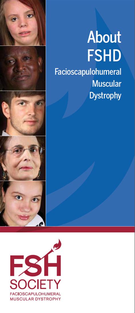 New brochure on facioscapulohumeral muscular dystrophy | FSHD Society