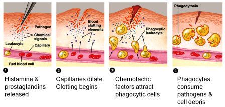 What is inflammation and the steps in the process of inflammation ...