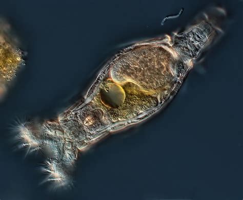 Rotifer - Alchetron, The Free Social Encyclopedia