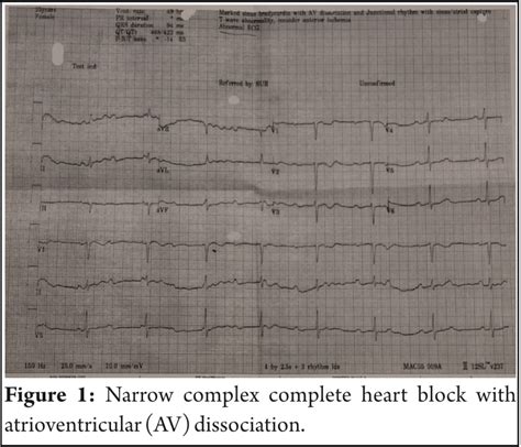 Anesthetic management of a patient with congenital complete heart block posted for emergency ...