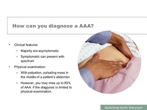 Abdominal Pain as related to Abdominal aortic aneurysm - Pictures