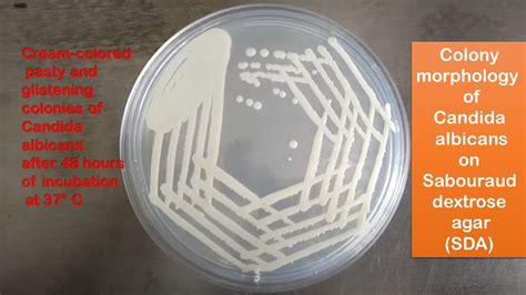 Sabouraud Dextrose Agar (SDA): Introduction, Principle, Composition, Pre