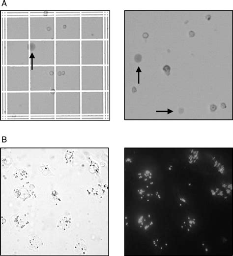 Figure 14.4 from Isolation of liver Kupffer cells. | Semantic Scholar