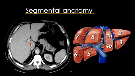 Liver Segmental Anatomy Ct Scan