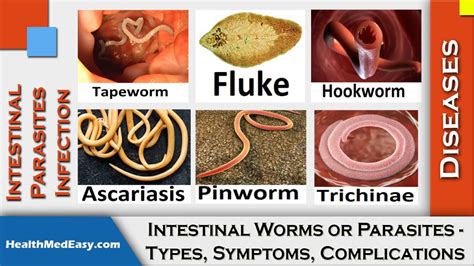 Worms (Intestinal) - Symptoms, Types, Complications - HealthMedEasy.com ...