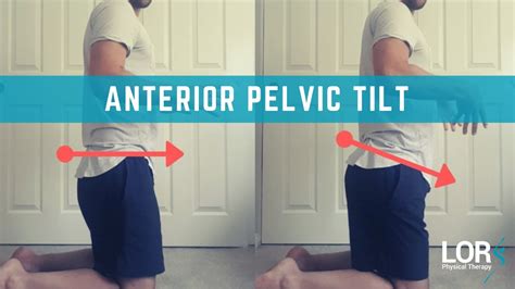 Quick Test For Anterior Pelvic Tilt, and Why It's SO important to ...