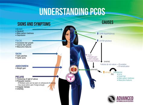 Know the Symptoms of Polycystic Ovarian Syndrome