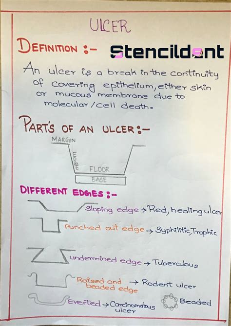 Definition and Classification of Ulcer