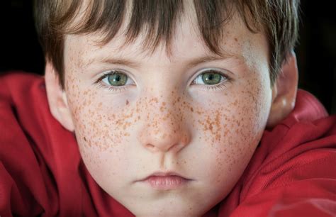 What Causes Fabulous Freckles? - Kids Discover