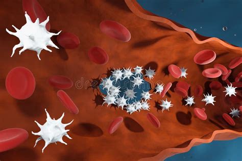 Platelets Repair the Wound in the Blood Vessel. 3d Render. Stock Illustration - Illustration of ...