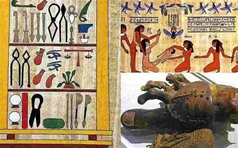 Ancient Egyptian medicine