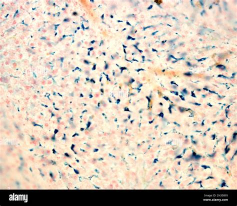 Liver Histology Kupffer Cells