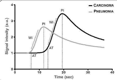 Signal intensity in arbitrary units (a.u.) as a function of time in... | Download Scientific Diagram