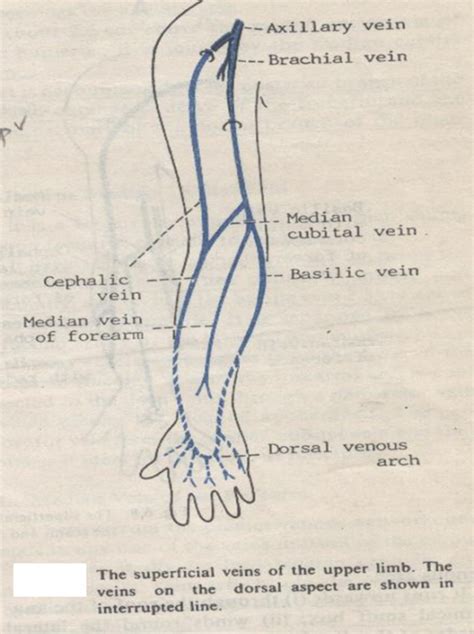 cephalic vein thrombosis - ModernHeal.com