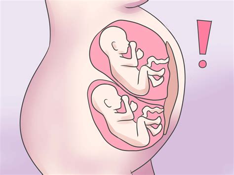 High Risk Pregnancy as related to Preeclampsia - Pictures