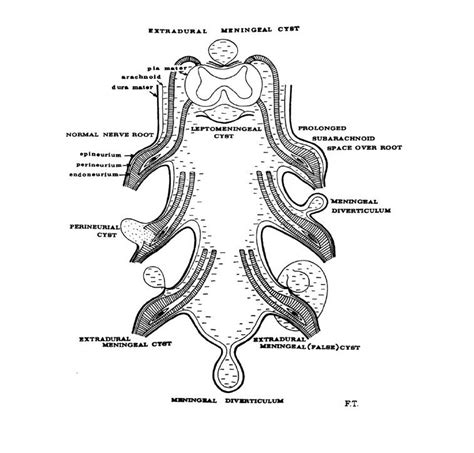 Pin on EDS3 - Hypermobility Syndrome - BJHS - Chronic Pain