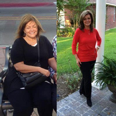 Real Bariatric Surgery Success Stories