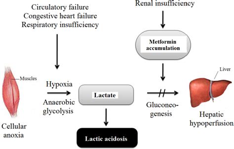 Metformin induced lactic acidosis--particularities and course ...