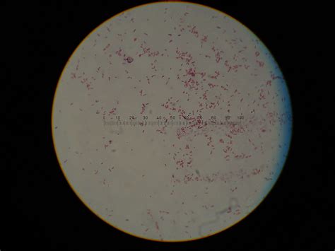 Escherichia coli | Gram stained smear, 100X (oil immersion).… | Minyoung Choi | Flickr