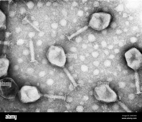 Bacteriophage Virus Electron Microscope