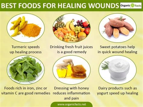 Best foods for healing wounds - infographic Healing Food, Wound Healing, Natural Healing, Foods ...