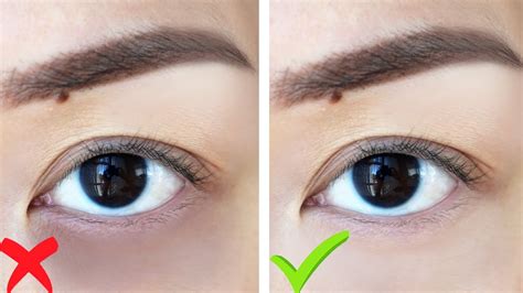 HOW TO: Get Rid Of Dark Circles WITHOUT MAKEUP! - YouTube