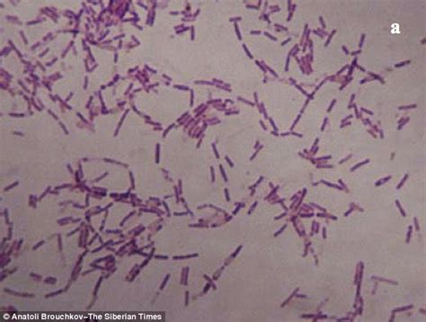 3.5m-year-old Siberian Bacillus F bacteria boosts longevity and the immune system | Daily Mail ...