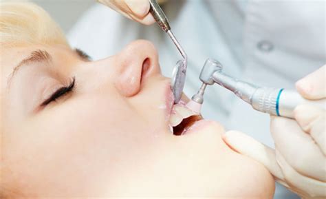 Scaling & Polishing Dental Treatments in Vadodara