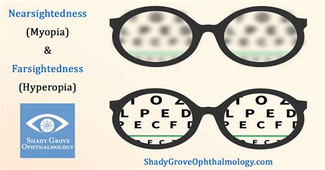 Nearsightedness & Farsightedness - Shady Grove Ophthalmology: Anthony ...