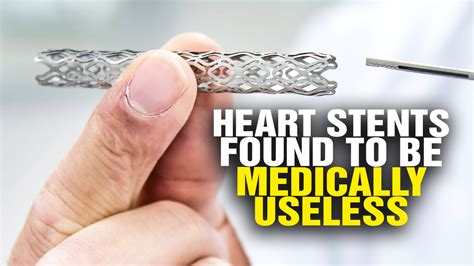 Heart stent FAIL: Shocking study shows heart stents are medically ...