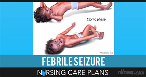 5 Benign Febrile Convulsions Nursing Care Plans | Nursing care plan ...