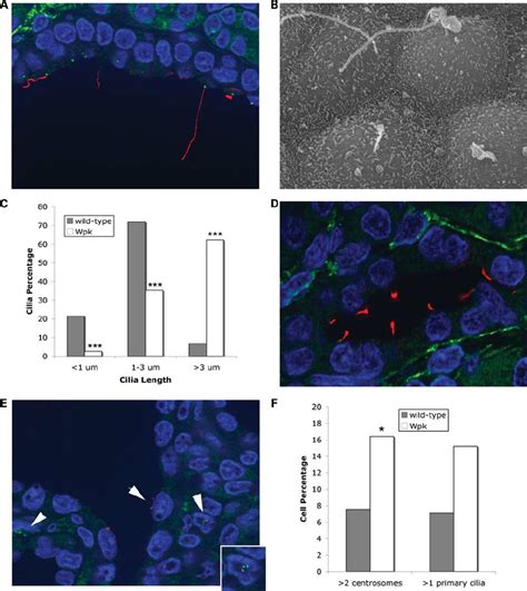 Analysis of cilia length and abnormalities of centrosome and cilia... | Download Scientific Diagram