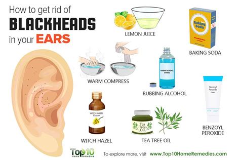 How to Get Rid of Blackheads in Your Ears | Top 10 Home Remedies