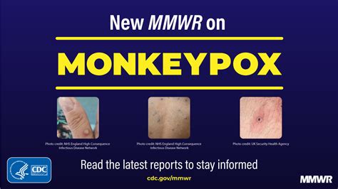 CDC on Twitter: "New @CDCMMWR finds patients with severely weakened immune systems, such as ...