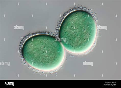 Blue green algae microscope hi-res stock photography and images - Alamy