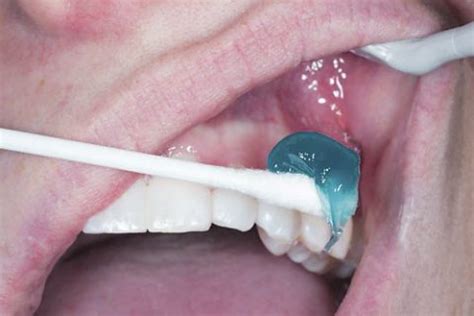 How to reduce dental injection pain? | Tooth Fairy