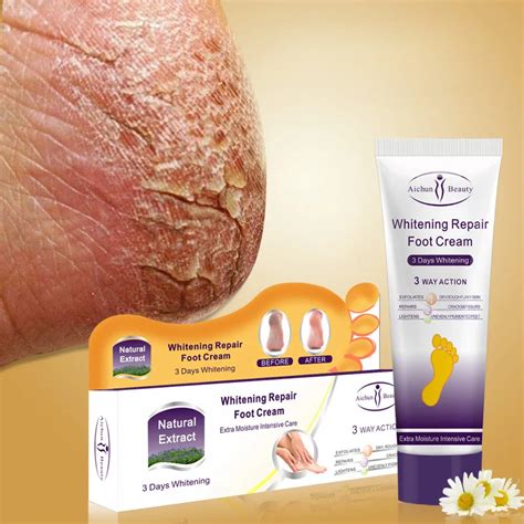 Aichun Crack Heel Cream Repair Anti Crack Whitening Foot Peeling ...