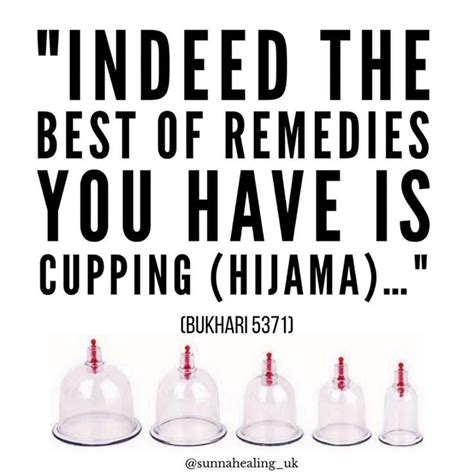 Pin on Hijama