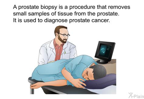 PatEdu.com : Prostate Biopsy