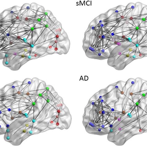 Brain connectivity graphs in NC, pMCI, AD and sMCI. Brain inter-... | Download Scientific Diagram